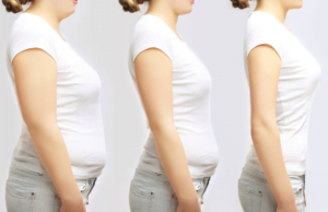 Woman Loses 140 Pounds, Ends Up Needing Surgery In Foreign Hospital